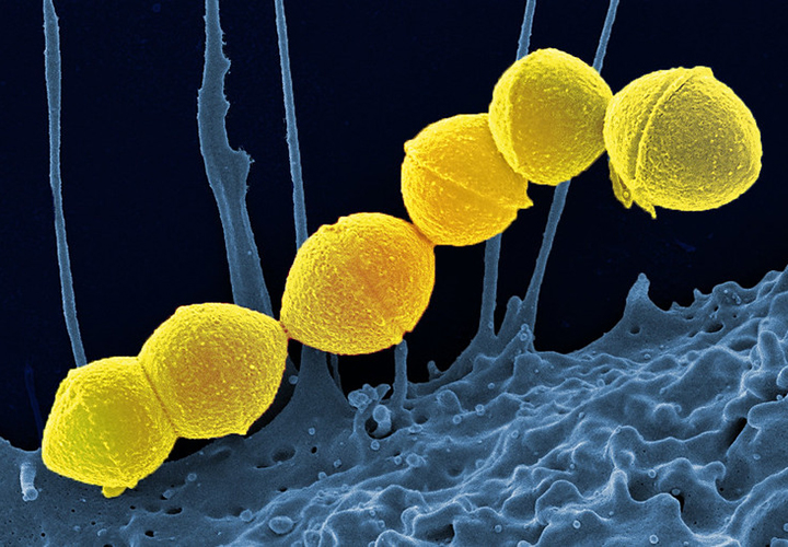 Increase in invasive Group A streptococcal infections in children